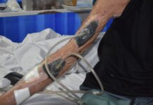 Kangaroo attack victim speaks