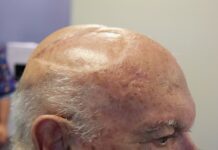 A haircut saved Robin’s life